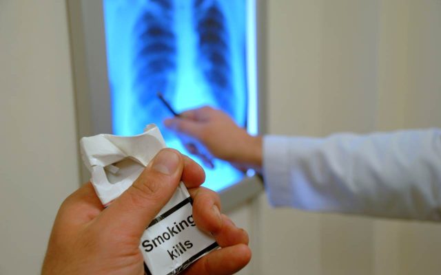 Thuốc lá là nguyên nhân chính gây nên bệnh phổi tắc nghẽn mạn tính (COPD)