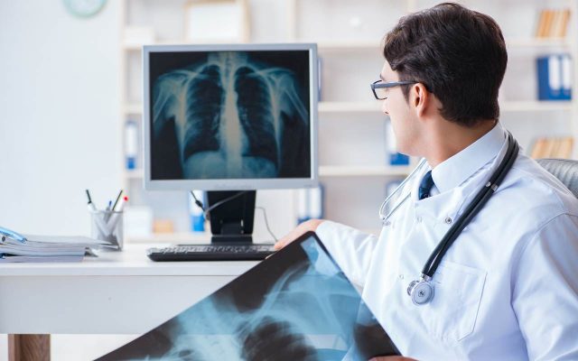 Chụp x-quang giúp nhìn nhận rõ hơn về tình trạng phổi