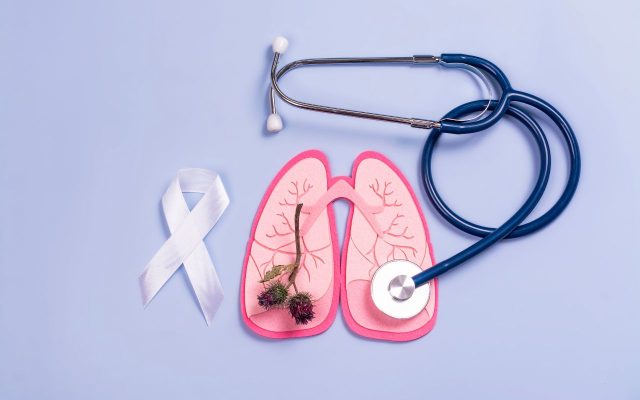 Ung thư phổi có mối liên hệ nhất định với bệnh phổi tắc nghẽn mạn tính